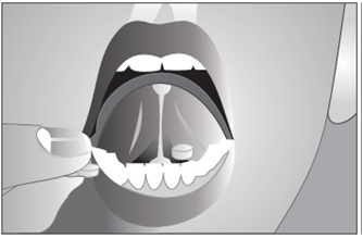 Buprenorphine